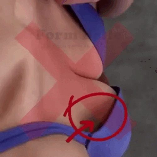 Sutiã sem marcar nas costas